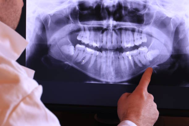 Best Emergency Tooth Extraction  in Clyde, NC